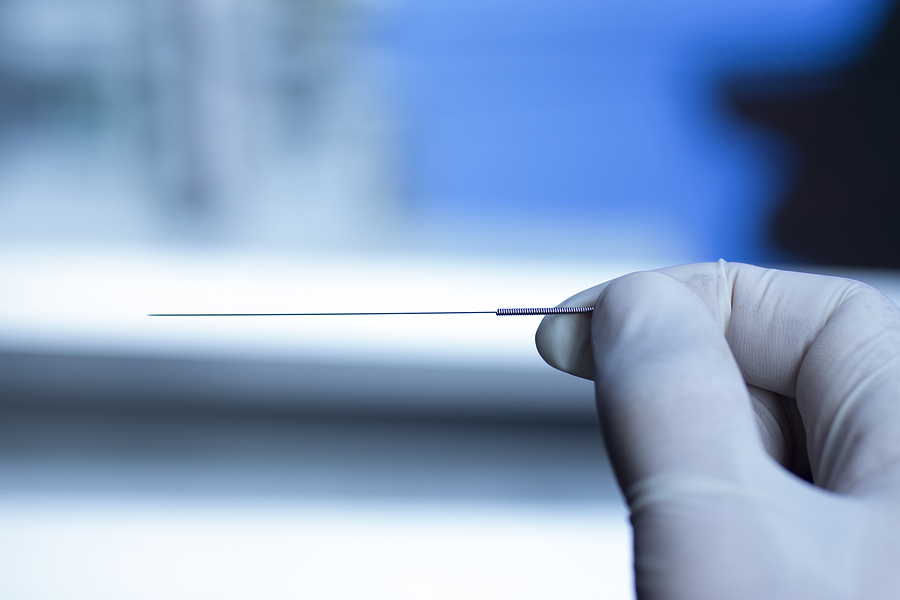 Dry Needling vs Acupuncture header. Acupuncture needle used for dry needling rehabilitation medical treament for physiotherapy and pain due to physical injury in the hand of the doctor.